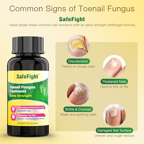 Toenail Fungus Treatment Extra Strength - with 25% Undecylenic Acid - SafeFight Nail Repair Solution for Damaged Nails, Ingrown Nails & Discoloration, 30ML 1 Pack 30ML(1 Pack)