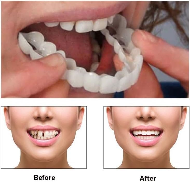 2 Pairs Hand Washable Durable Accessory with Secure Fit for Daily Visual Enhancement & Casual Meetups Teeth Whitening Kits（Shell White） Shell White 1 Count (Pack of 2)