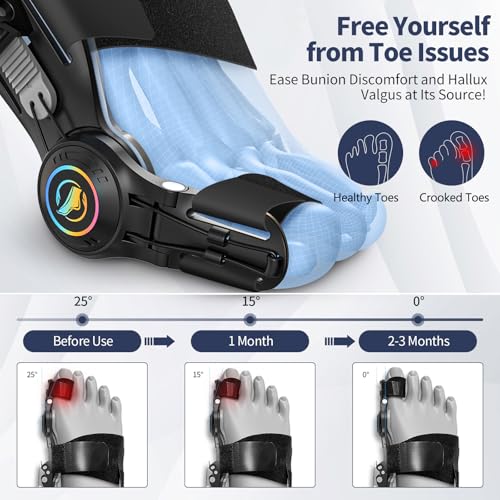 Kutain Upgraded Bunion Corrector for Women and Men, Big Toe Spacers(1PCS) Black 1