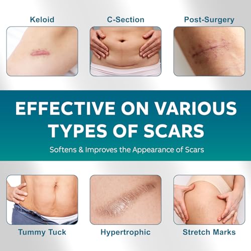 Scar Gel, Scar Cream, Advanced Scar Gel for Surgical Scars, Scar Cream for Surgical Scars, C-Section, Tummy Tuck, and Keloid 50g