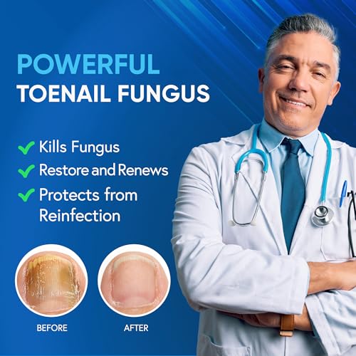 Toenail Fungus Treatment Extra Strength - Nail Repair with 25% Undecylenic Acid & Tea Tree Oil : Fingernails for Damaged Nails and Thick Toenails- 2Pcs 0.5 Fl Oz (Pack of 2)