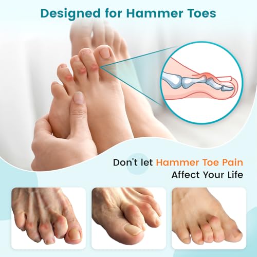Hammer Toe Straightener Corrector Splint Brace for Women fit 2nd 3rd and 4th Toes - (L-Blue) - 1 Pair L Blue