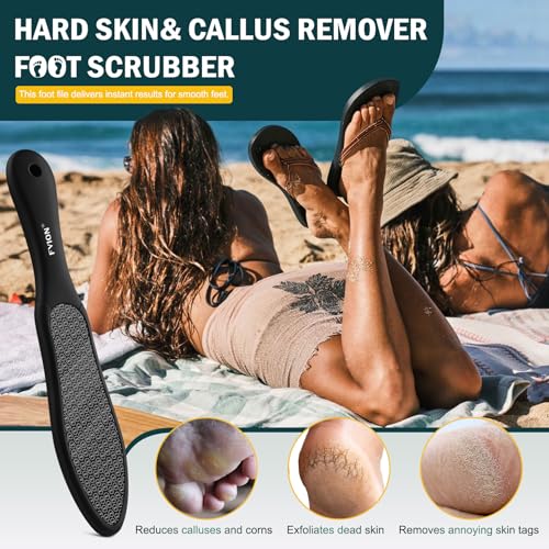 FVION Double-Sided Nano Glass Foot File for Callus Remover - Highly Effective Hard and Dead Skin Remover for Cracked Heels and Dry Skin (Black) Black
