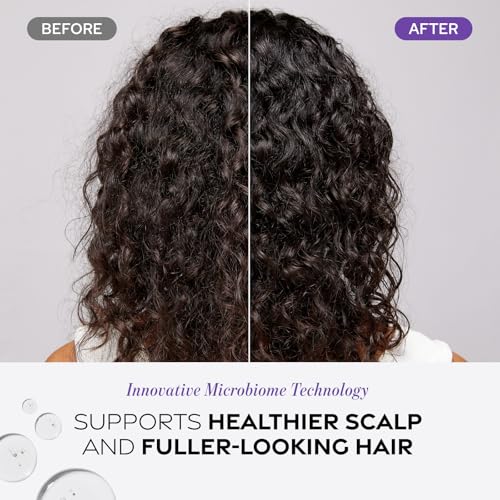 Dr. Groot Scalp Exfoliating Detox Water for Hair Loss, Korean Hair Care, AHA to remove Sebum, Purify Scalp, Menthol Refreshing, Scalp Revitalizing Solution
