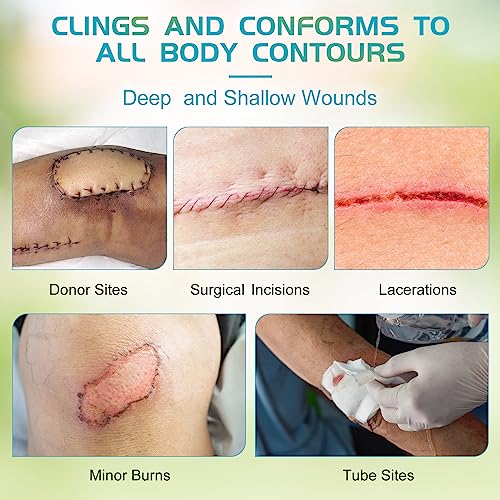 Xeroform Petrolatum Dressing Non-Adherent Occlusive Fine Mesh Gauze Pad, Gentle Patch for Burns, Laceration, Surgical Incisions & Skin Grafts (4"x4" Pack of 25) 4"x4" pack of 25