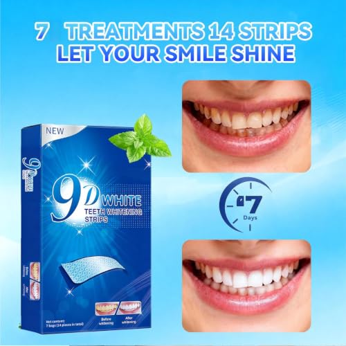 Teeth-Whitening Strips for Sensitive Teeth - Teeth Whitening Kit Professional Effects, Teeth Whitener for Enamel Safe, 14 White Strips (7 Day Treatment) Remove Stains for a Brighter Smile, Mint 14 Count (Pack of 1)