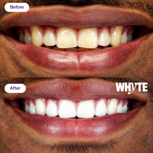 Whyte Purple Whitening Strips for Sensitive Teeth