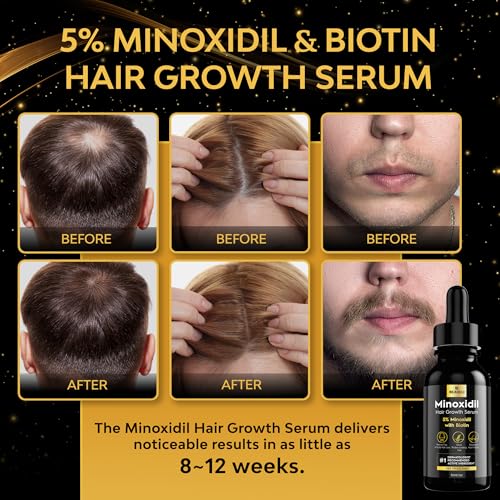 Beaueli 5% Minoxidil for Men and Women, Hair Growth, Beard Growth, Hair Regrowth, Unscented Drop, 3 Fl Oz, 3 Bottles 1 Fl Oz (Pack of 1) 30ml - 3 bottles