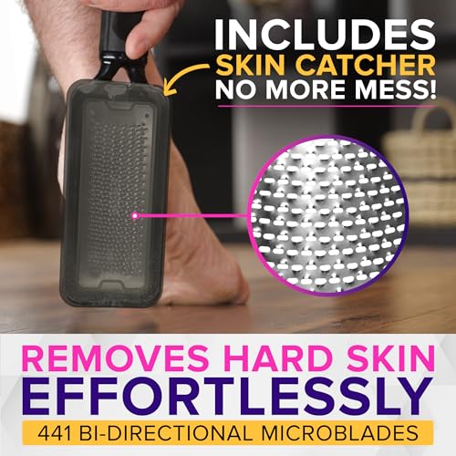 NYK1 RUSTPROOF Foot File Callus Remover for Feet with Catcher | XL Size