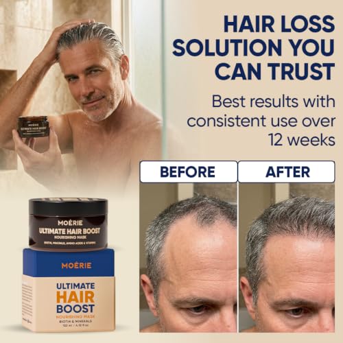 Moerie Mineral Hair Growth & Repair Mask – Hair Loss treatment Mask – Hair Regrowth For Longer, Thicker, Fuller Hair - Vegan Friendly – Paraben & Silicone Free Single Set