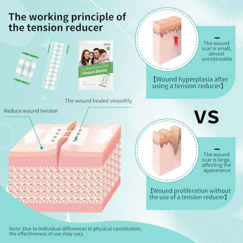 Hydrocolloid Wound Zipper Wound Closure Strips Zip Stitch Sutures Butterfly Bandaids Emergency Laceration Closure Kit for Lacerations Incisions Cuts（5x7cm）