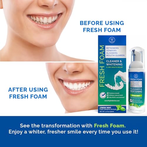 Retainer Cleaners Bundle | Aligner & Retainer Cleaner Fresh Foam | Retainer Cleaner Tablets for Invisalign Approved for Ultrasonic Cleaners 4-Month Supply