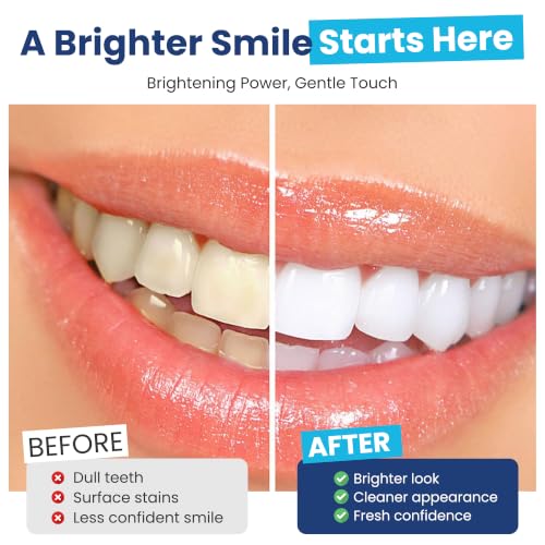Pro White Teeth Whitening Strips - Peroxide Free Pap-X Formula, Fresh Mint Flavor, 14 Strips / 7 Treatments, Vegan Certified - Enamel Safe Teeth Whitening Strips for Brighter Smile - Pack of 1 1 Count (Pack of 14)