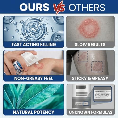 Antifungal Ringworm Treatment Cream, - Miconazole Nitrate 2% Antifungal Cream for Humans - For Fast Itch Relief, Jock Itch & Athlete's Foot - Cream with Ceramides & Tea Tree Oil, Non-Greasy, 3.53oz