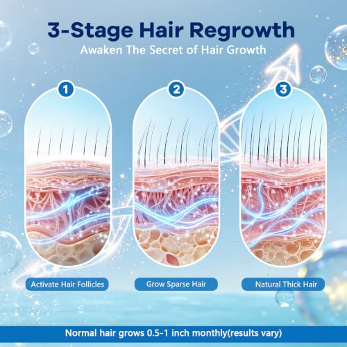 Men's 5% Topical Minoxidil Aerosol Foam Unscented, Biotin Infused Hair Beard Growth Treatment for Thicker Fuller Hair, Comparable to Rogaine Active Ingredient, 8.44oz 4 Month Supply 2.11 Count (Pack of 4)