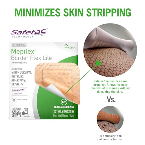 Mepilex Border Flex Lite 4 x 4 in (10 x 10 cm) Hospital Quality Dressings