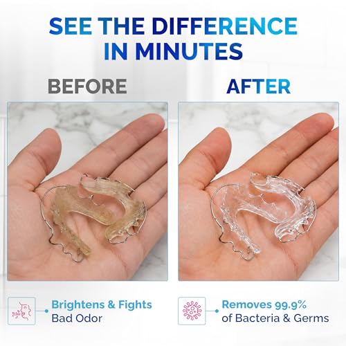 120 units Retainer Cleaner and Denture Cleaning Tablets - Mouthguard cleaner and Denture cleaner tablets Remove Plaque, Odors and Stains from Aligners, Night guard and Removable Dental Appliances 120 Count (Pack of 1)
