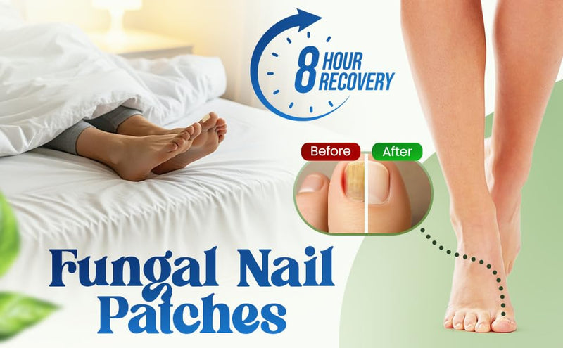 Premium Fungal Nail File Patches Toe Foot Repair Care Extra Fungus Strength 21 Pcs Nighttime Damaged Treatment Toenail ingrown Nails Strengthen 8 Hour Safe Sensitive gift for Women Men .(21 Count) 21 Count - BeesActive Australia