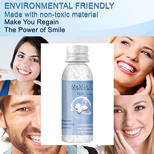 Tooth Repair Kit, Temporary Restoration of Missing & Broken Teeth, 1Pcs 30ml*1