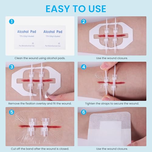 Wound Closure Strips, Zip Stitch Laceration Closure Kit, 12 PCS 2-Straps