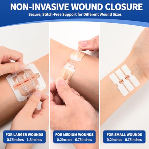 Emergency Wound Closure Strips Kit, 3 Types Butterfly Bandages, Laceration Closure Kit with Cleaning Wipes, Stitchless Wound Closures Device for First Aid (Mix 52Pack) Mix 52Pack