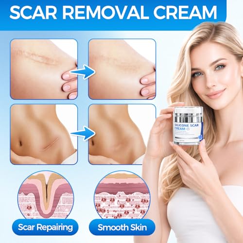 Scar Cream, Silicone Scar Gel, Professional Scar Removal Cream for Surgical Scars, Stretch Marks, Keloids, Burns, Acne, Old and New Scars, 1.76 oz (50ml) 50g