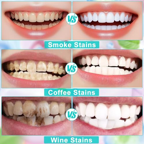 Niacinamide Whitening Toothpaste Natural Mild and Non-Irritating Nicotinamide White Toothpaste Prevents Tooth Decay Freshens Breath, and Promotes Oral Health 2