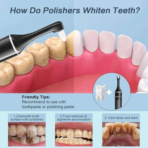 Tooth Polisher,Rechargeable Tooth Whitening Kit for Teeth Cleaning and Whitening, with 8 Brush Heads, LED Light, 5 Speed Modes Dental Polisher Personal Dental Care Kit for Home Use and Travel Black