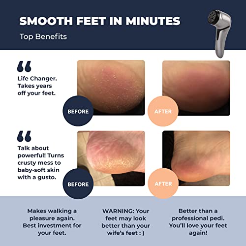 Electric Foot Callus Remover with Vacuum - Own Harmony Professional Pedicure Tools Kit for Powerful Pedi Feet Care Vac, Electronic Foot File CR2100, Best for Hard, Dry, Cracked, Dead Skin (3 Rollers) Quantum Silver