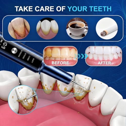 Plaque Remover for Teeth, Dental Cleaning Kit Tartar Remover for Teeth with LED Light & 5 Modes, Rechargeable Dental Cleaner, 3 Replaceable Heads