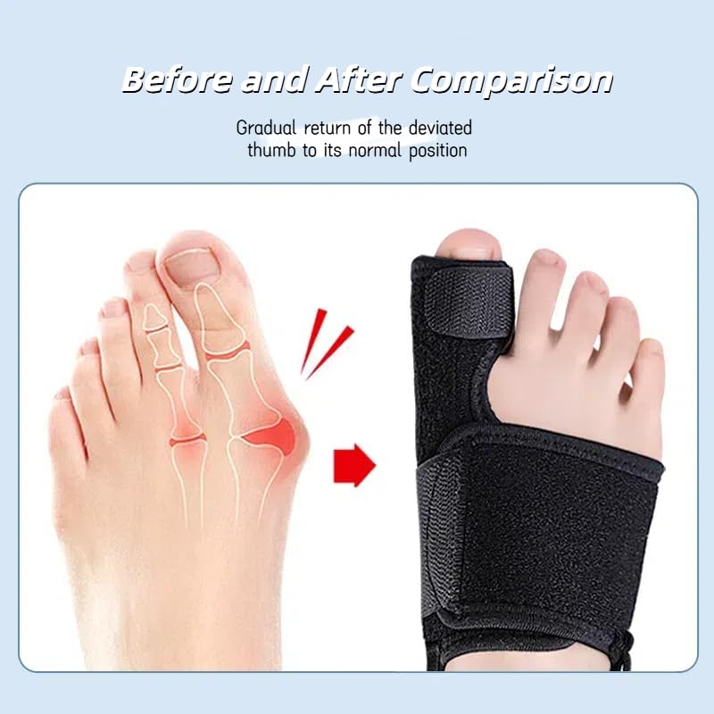 Toe Brace - Big Toe Taping Splint Straightener Wrap with Support Straps for Sprains and Hallux Rigidus Relief (Left And Right) Left And Right