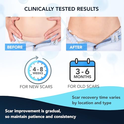 Silicone Scar Gel: Silicone Gel for Scars - Scar Cream - Advanced Scar Removal Cream for Old and New Scars - Medical Grade Silicone - Scalds Surgery Injury Stitches Burns - Fast Absorbing - 20g