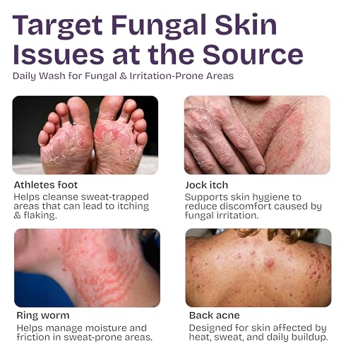 Antifungal Body Wash with Tea Tree Oil | Eczema Body Wash Treats Ringworm, Back Acne & Jock Itch | Antifungal Soap For Men And Women with 1% Tolnaftate 16.9 Fl Oz (Pack of 1)