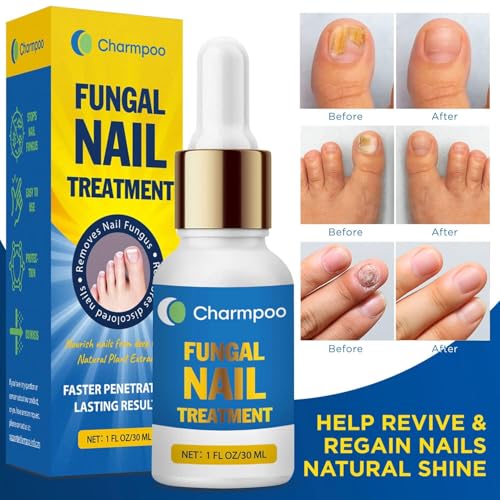 Toenail Fungus Treatment Extra Strength 30ml: Nail Cuticle Care Serum – Infused with Botanical Herbal Extracts for Clear Healthy-Looking Nails Lightweight Daily Nail & Toe Care