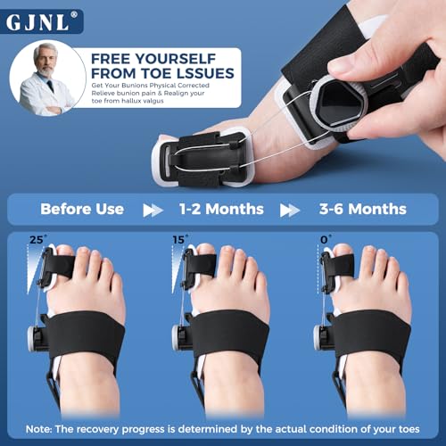 GJNL Bunion Corrector for Women & Men – Upgraded Adjustable Bunion Fix for Big Toe Separation Pain Relief, Bunion Splint Suitable for Left/Right Feet, Toes Alignment Hallux Valgus Correction (Black) Black