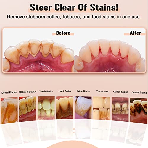 Plaque Remover for Teeth, Electric Tartar Remover for Teeth with LED Light,4 Modes Rechargeable