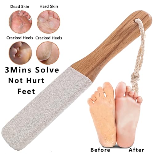 Kinepi Callus Remover Foot File, Pumice Stone for Feet Scrubber Wet and Dry Flat