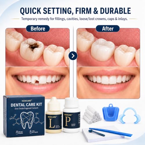 Zinc Oxide Eugenol Dental Cement Care Kit, Instant Tooth Filling Dental Glue Kit, High Strength Self-Curing, Home Oral Temporary Tooth Repair