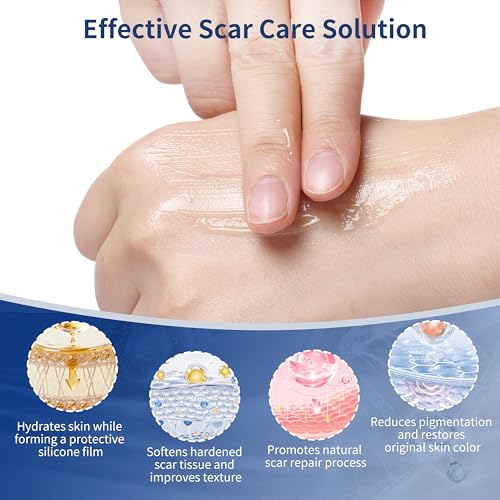 HBM Medical Silicone Scar Gel, Medical Grade Scar Care for Old & New Scars 30g