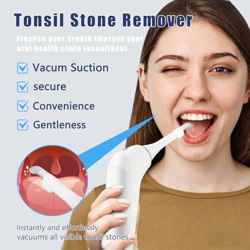 Electric Tonsil Stone Remover with Camera, 3 Suction Levels Vacuum Kit, USB Rechargeable Oral Care for Tonsil Stone Removal（White） White