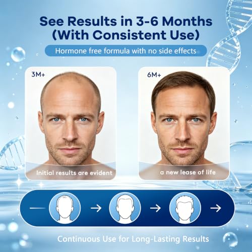 Men's 5% Topical Minoxidil Aerosol Foam Unscented, Biotin Infused Hair Beard Growth Treatment for Thicker Fuller Hair, Comparable to Rogaine Active Ingredient, 8.44oz 4 Month Supply 2.11 Count (Pack of 4)