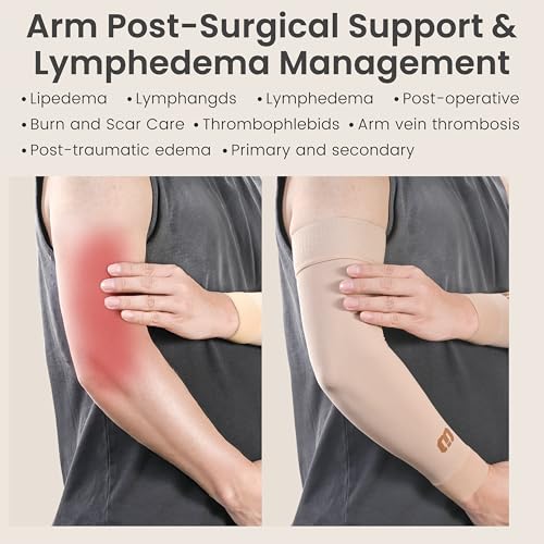 MGANG Medical Compression Arm Sleeve 15-20 mmHg, Lymphedema & Post-Surgery Beige (15-20 Mmhg With Silicone Band) Medium(Single)