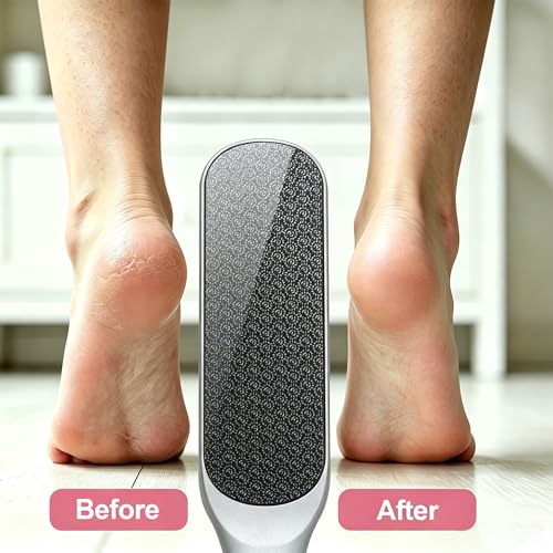 OWIIZI Double Sided Foot Callus Remover Nano Glass Foot File Durable Foot Scrubber Pumice Stone with Handle for Feet Exfoliation Pedicure Tools for Feet Care Exfoliate Dry & Hard Skin (Grey) Grey