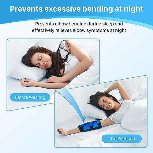Cubital Tunnel Elbow Splint, Ulnar Nerve Night Brace, for Women & Men, Arm Elbow Splint Support for Left and Right, Built-in 3 Support Plates -S/M S/M