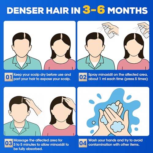5% Minoxidil for Men and Women，Minoxidil hair growth products，Intense Hair Growth Serum，May Promote Faster, Stronger, Thicker Hair Growth to Fight Hair Loss and Thinning Hair（2.82 oz*4) 2.82 Count (Pack of 4)