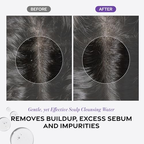 Dr. Groot Scalp Exfoliating Detox Water for Hair Loss, Korean Hair Care, AHA to remove Sebum, Purify Scalp, Menthol Refreshing, Scalp Revitalizing Solution