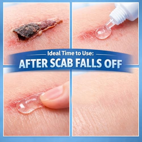 Morovan silicone scar removal Gel: Scar cream for Body and face Effectively minimizes the appearance of Scars from Stretch Marks Surgical Scar Keloids Acne Burns and Other, New scar 6 weeks