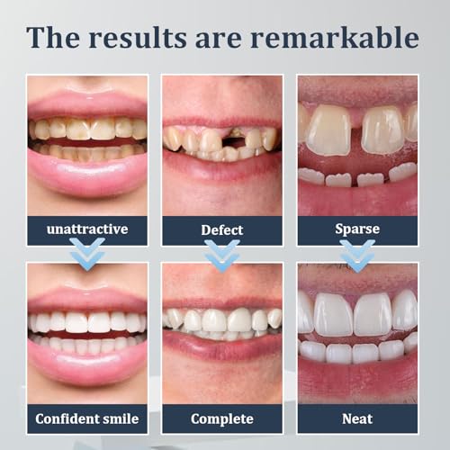 2 Pairs Temporary Smile, Adjustable Comfortable Fit for Men and Women (Bright White4) Bright White4