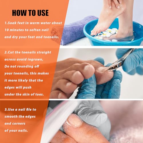 LePinko Podiatrist Toenail Clippers, Thick and Ingrown Nails Clippers, 1PCS 1 piece