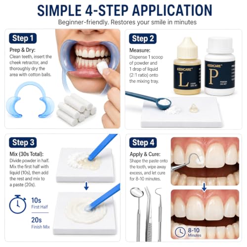 Zinc Oxide Eugenol Dental Cement Care Kit, Instant Tooth Filling Dental Glue Kit, High Strength Self-Curing, Home Oral Temporary Tooth Repair